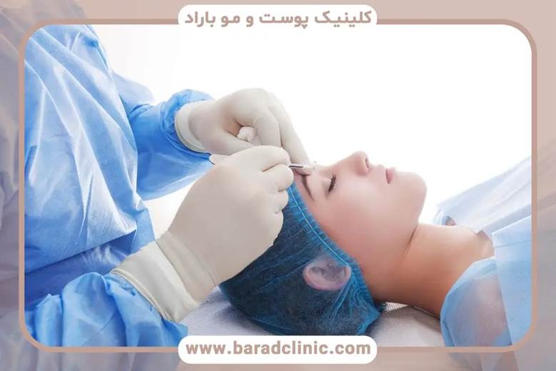 هزینه بلفاروپلاستی در سال 1404 چقدر است؟