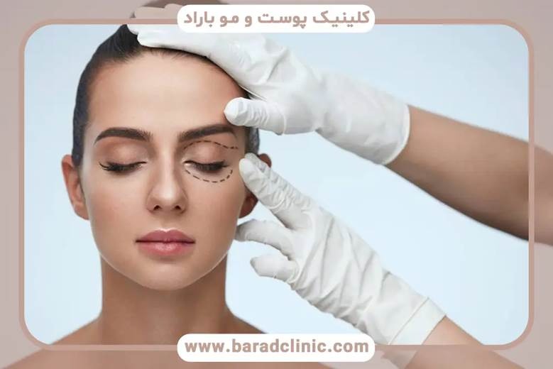 کلینیک انتخابی و تاثیر آن روی قیمت بلفاروپلاستی