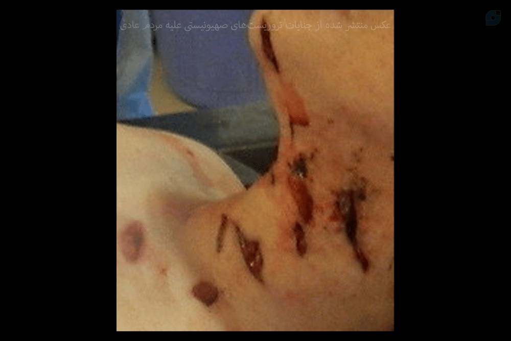 قتل عام مردم ایران توسط عوامل موساد