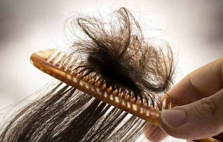این 5 بیماری پنهان را از ظاهر موهای‌تان تشخیص دهید