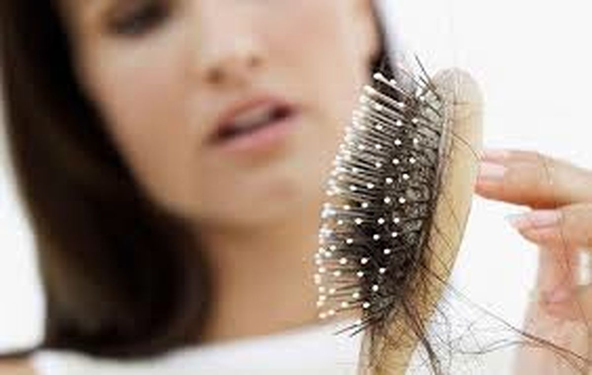 آشنایی با دلایل ریزش موهای سر