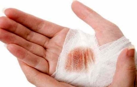 خوراکی های مفید و موثر برای درمان زخم