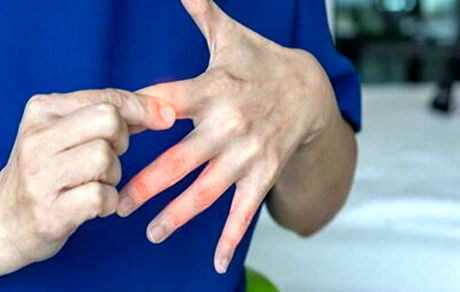 یک هشدار جدی درباره بی حسی و درد انگشتان