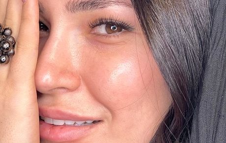 چهره نصفه نیمه خانم بازیگر + عکس