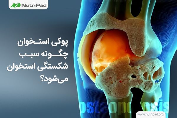 چرا سلامت استخوان‌ ها در سنین پایین به چالشی جدی تبدیل شده است؟