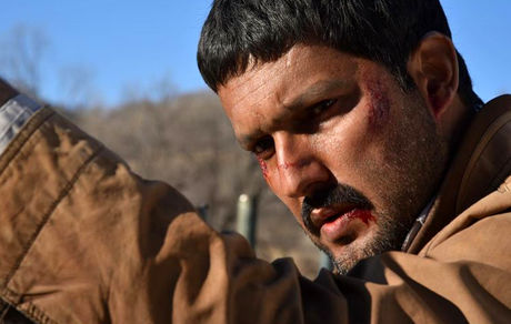 زخمی شدن حامد بهداد + عکس