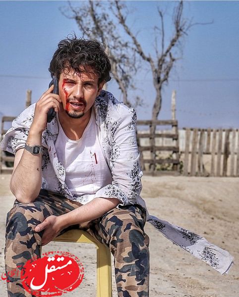 مجروحیت بازیگر فوق لیسانسه ها + عکس