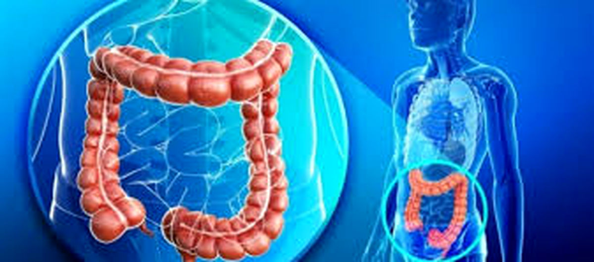 درباره بیماری التهابی روده چه می‌دانید؟