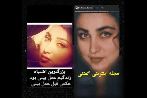 تصویری دیده نشده از بهنوش بختیاری قبل عمل زیبایی