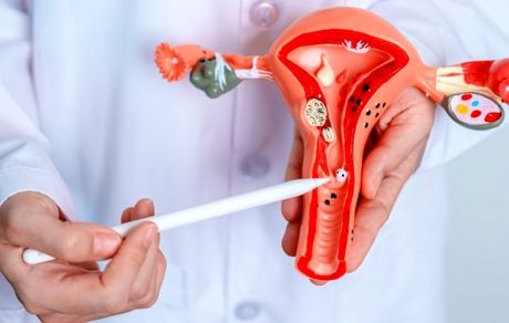 هشدار؛ نفخ مداوم، نشانه‌ای از سرطان تخمدان است!