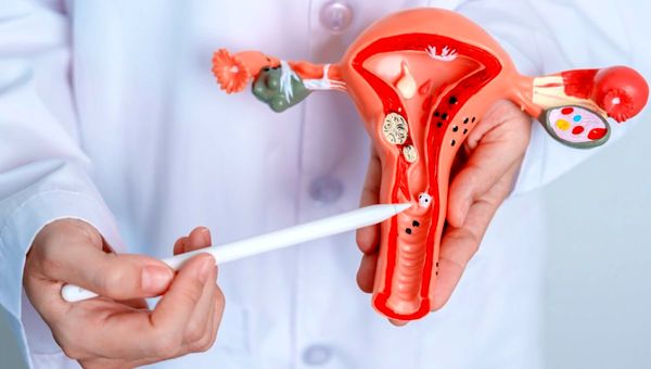 هشدار؛ نفخ مداوم، نشانهای از سرطان تخمدان است!