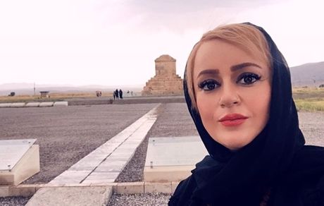 کاهش وزن شدید خانم بازیگر + عکس