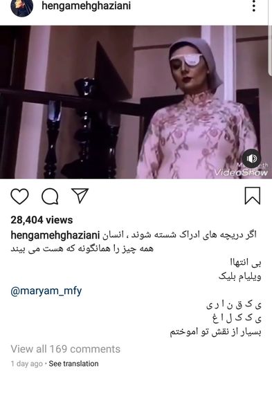 عکس چشم مجروح هنگامه قاضیانی 