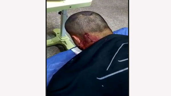 حمله وحشیانه زورگیران خشن به جوان کرجی +عکس دلخراش از پشت سر شکافته شده