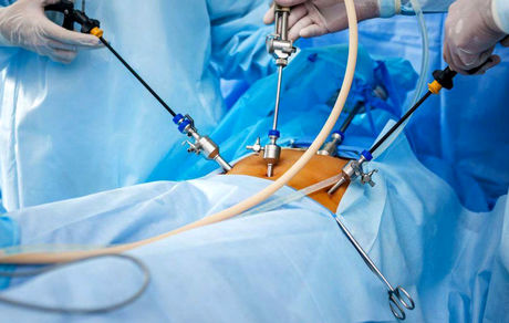 مرگ یک عرب‌ هنگام لیپوساکشن در مشهد