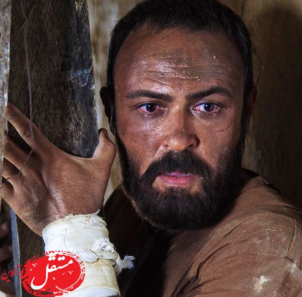 چهره آلوده و سیاه علیرضا کمالی + عکس